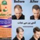 Sahara Care Regrowth Hair Oil in Pakistan – 030018